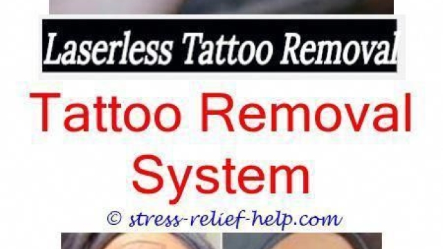 Laser Tattoo Removal – How Effective Is Them?