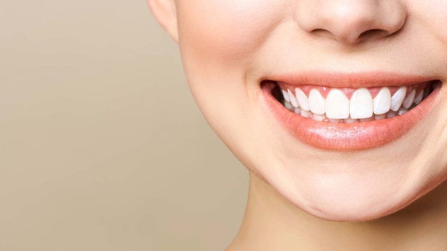 Sparkling Smiles: The Ultimate Guide to Teeth Whitening