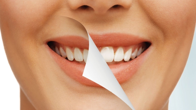 Sparkling Smiles: Unveiling the Secrets of Teeth Whitening Products