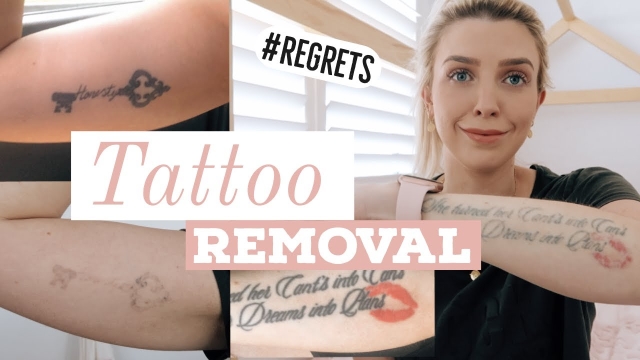 Tattooing Along With The Other Side Of The Coin – The Removal