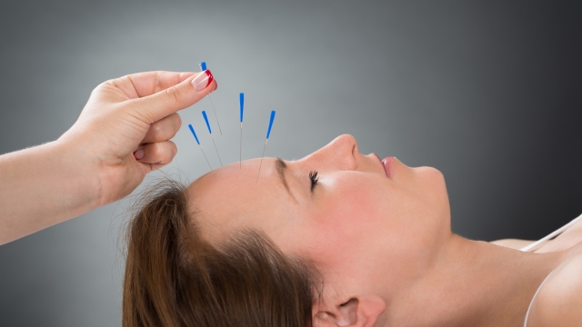 The Art of Acupuncture: Unleashing the Body’s Healing Powers